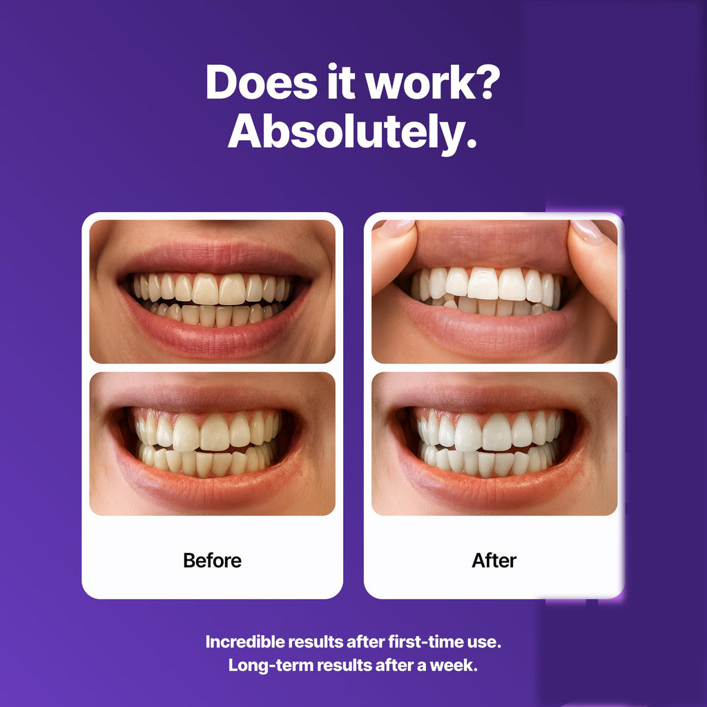 Dr. Dent Purple Teeth Whitening Strips